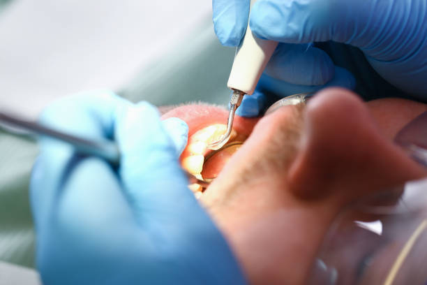 Best Broken or Cracked Tooth Emergency Dentist in West Falmouth, MA
