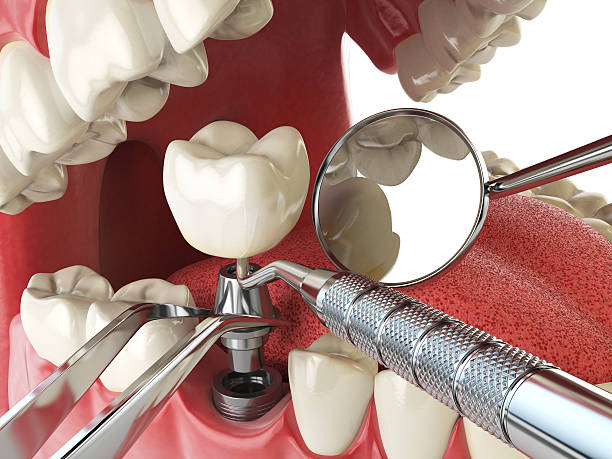 Best Emergency Dentist for Knocked-Out Tooth in West Falmouth, MA